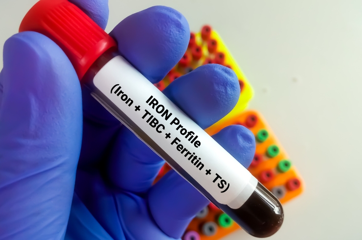 Iron Studies _ Iron Pr